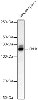 CBLB Rabbit polyclonal antibody