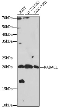 RABAC1 Rabbit polyclonal antibody