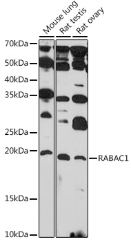 RABAC1 Rabbit polyclonal antibody