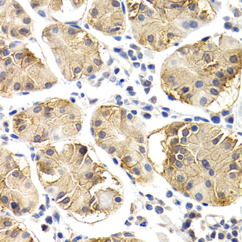 CHIT1 Rabbit polyclonal antibody