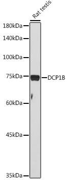 DCP1B Rabbit polyclonal antibody