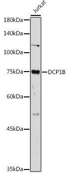 DCP1B Rabbit polyclonal antibody