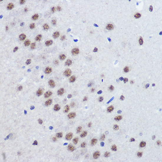 JMJD1C Rabbit polyclonal antibody