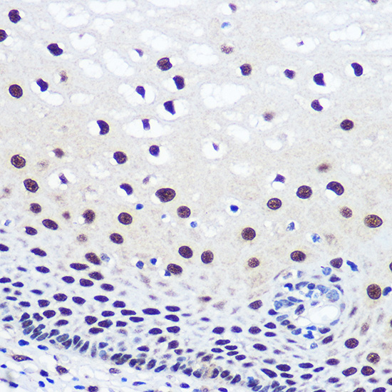 JMJD1C Rabbit polyclonal antibody