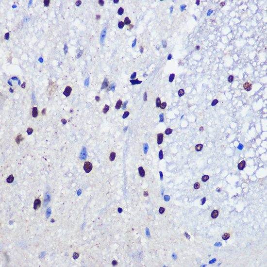 JMJD1C Rabbit polyclonal antibody