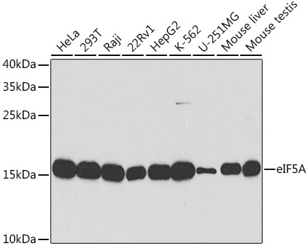 eIF5A Rabbit polyclonal antibody