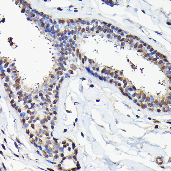 eIF5A Rabbit polyclonal antibody