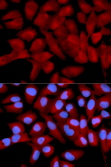 eIF5A Rabbit polyclonal antibody
