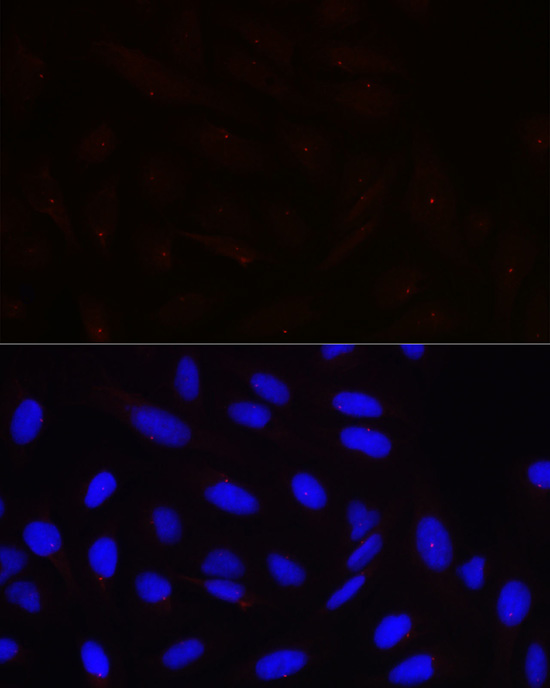 PCNT Rabbit polyclonal antibody