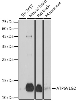ATP6V1G2 Rabbit polyclonal antibody
