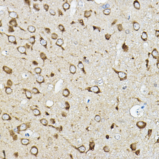 ATP6V1G2 Rabbit polyclonal antibody