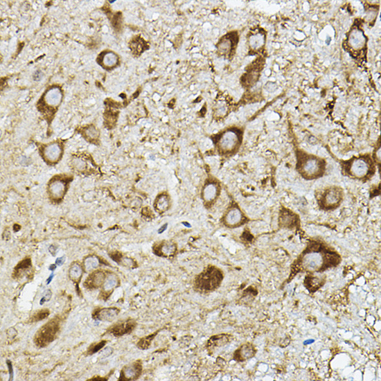 ATP6V1G2 Rabbit polyclonal antibody