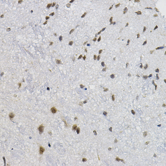 DNAJC17 Rabbit polyclonal antibody