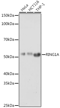 RING1A Rabbit polyclonal antibody