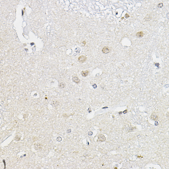 RING1A Rabbit polyclonal antibody