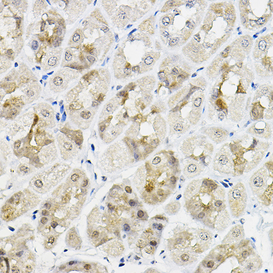 RING1A Rabbit polyclonal antibody