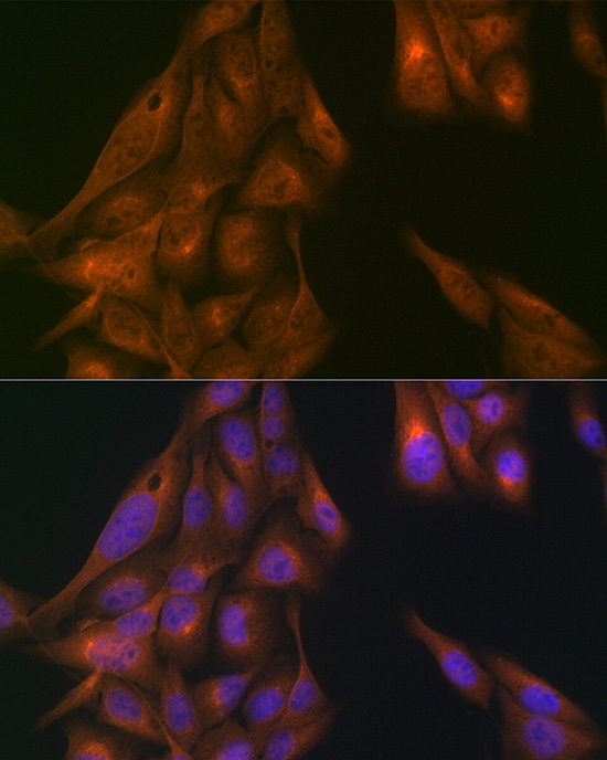 USP11 Rabbit polyclonal antibody