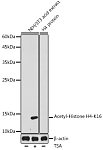 Western blot - Acetyl-Histone H4-K16 Rabbit pAb (A20186)