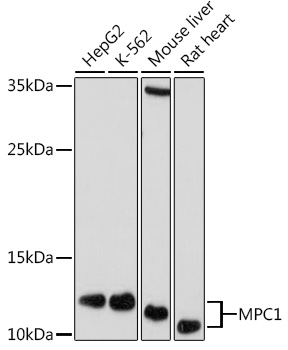 MPC1 Rabbit polyclonal antibody