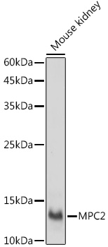 MPC2 Rabbit polyclonal antibody