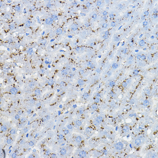 MPC2 Rabbit polyclonal antibody