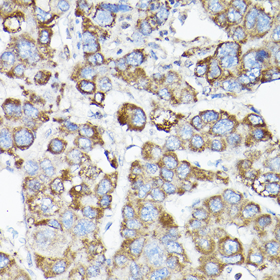 LLGL1 Rabbit polyclonal antibody