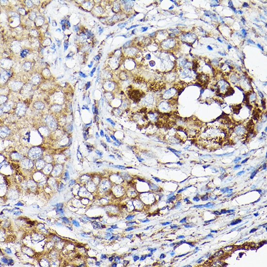 LLGL1 Rabbit polyclonal antibody