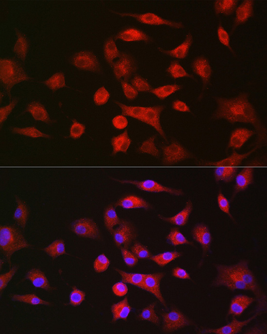 LLGL1 Rabbit polyclonal antibody