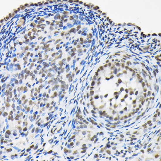 HNRNPA3 Rabbit polyclonal antibody