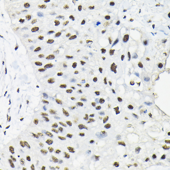 HNRNPA3 Rabbit polyclonal antibody