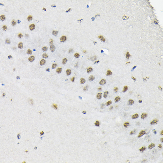 HNRNPA3 Rabbit polyclonal antibody