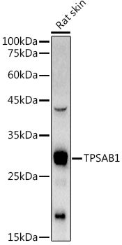 TPSAB1 Rabbit polyclonal antibody