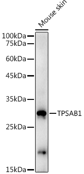 TPSAB1 Rabbit polyclonal antibody