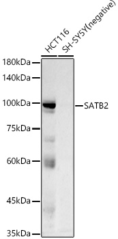 SATB2 Rabbit monoclonal antibody
