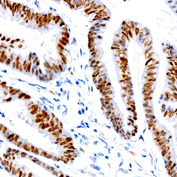 SATB2 Rabbit monoclonal antibody