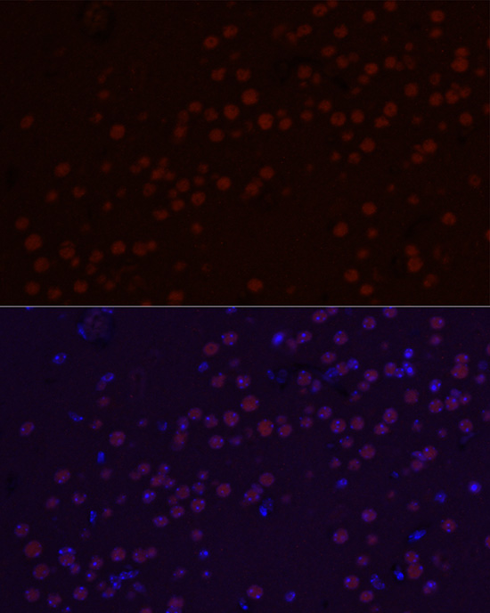SATB2 Rabbit monoclonal antibody