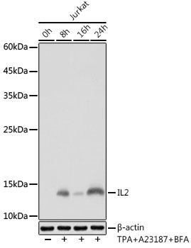 IL2 Rabbit monoclonal antibody