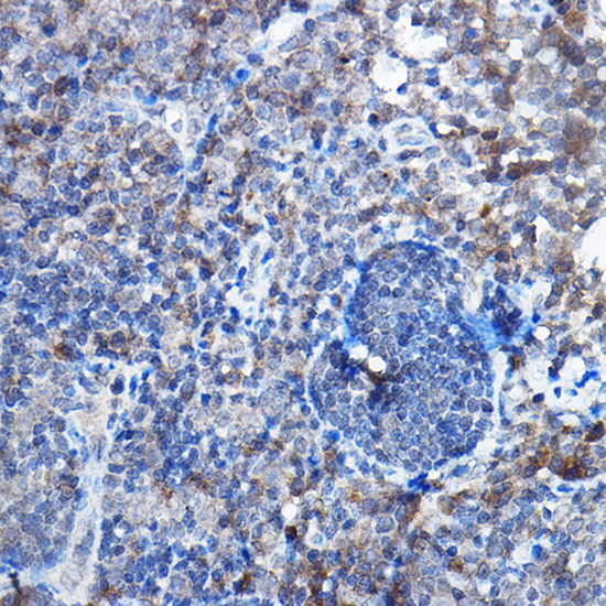 [KO Validated] Bax Rabbit monoclonal antibody