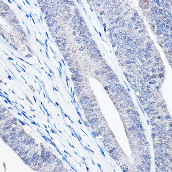 [KO Validated] Bax Rabbit monoclonal antibody