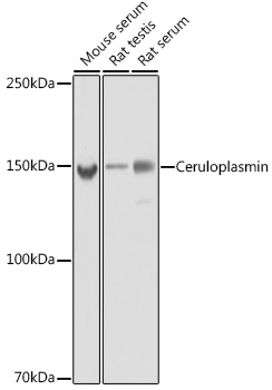 Ceruloplasmin Rabbit monoclonal antibody