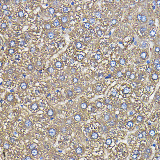 Ceruloplasmin Rabbit monoclonal antibody