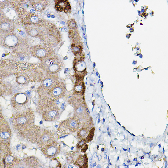 Ceruloplasmin Rabbit monoclonal antibody