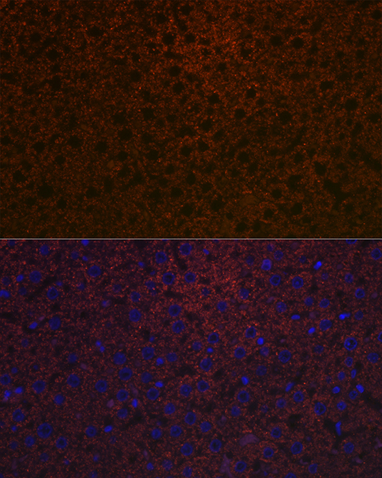 Ceruloplasmin Rabbit monoclonal antibody