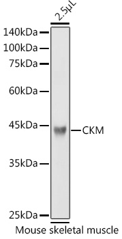 CKM Rabbit polyclonal antibody