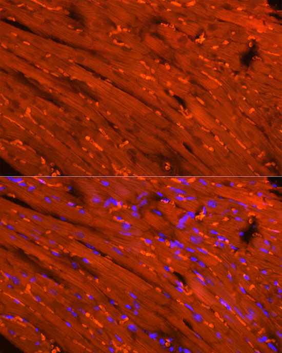 CKM Rabbit polyclonal antibody