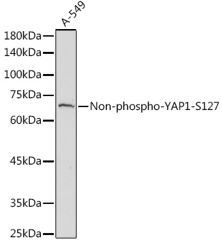 Non-phospho-YAP1-S127 Rabbit polyclonal antibody