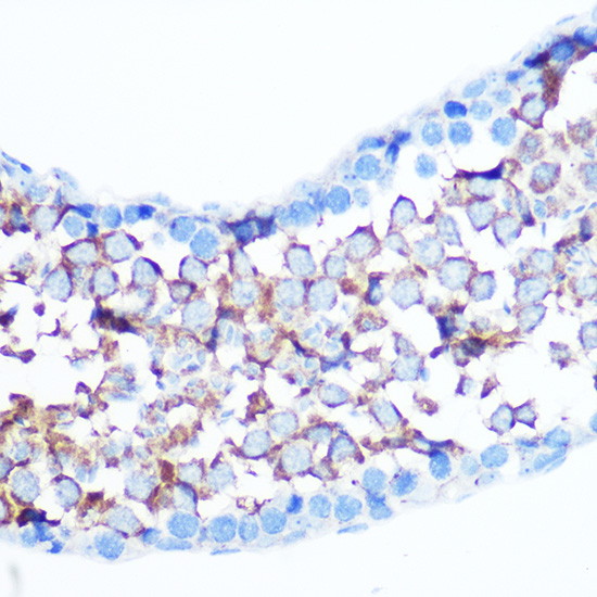Non-phospho-YAP1-S127 Rabbit polyclonal antibody
