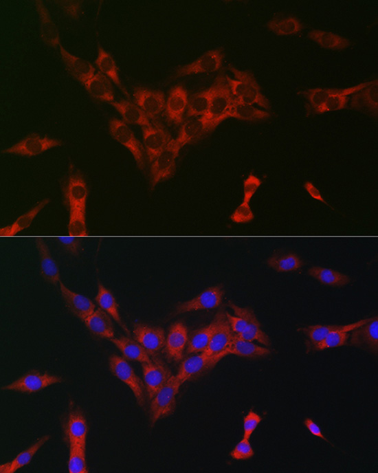eIF4A Rabbit polyclonal antibody