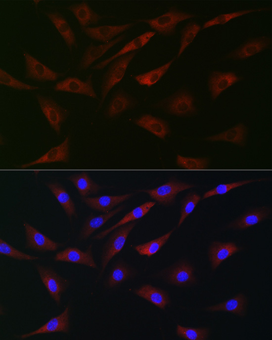 eIF4A Rabbit polyclonal antibody