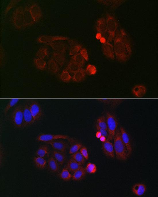 eIF4A Rabbit polyclonal antibody